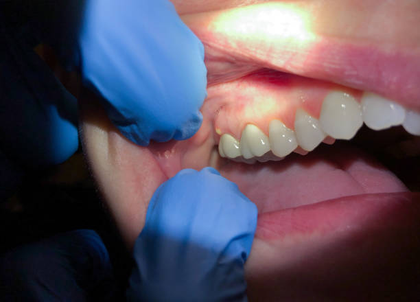 Best Pediatric Emergency Dentist in Neffs, OH